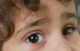 Photograph of a child's eyes